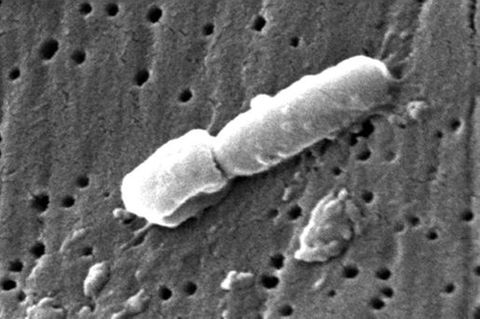 Mikroskop Aufnahme des multiresistenten Baktteriums Klebsiella pneumoniae