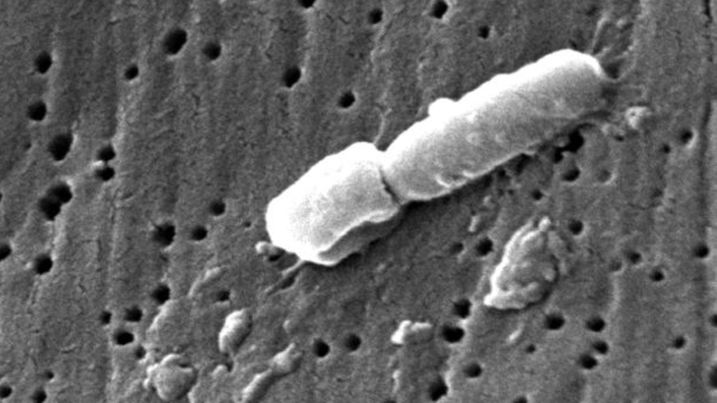 Mikroskop Aufnahme des multiresistenten Baktteriums Klebsiella pneumoniae