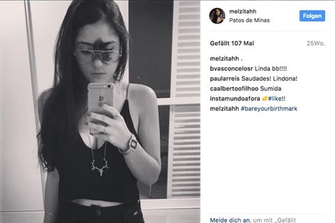 Die 24-jährigen Mariana Mendes macht ein Spiegel-Bild von sich, das ihr Muttermal zeigt
