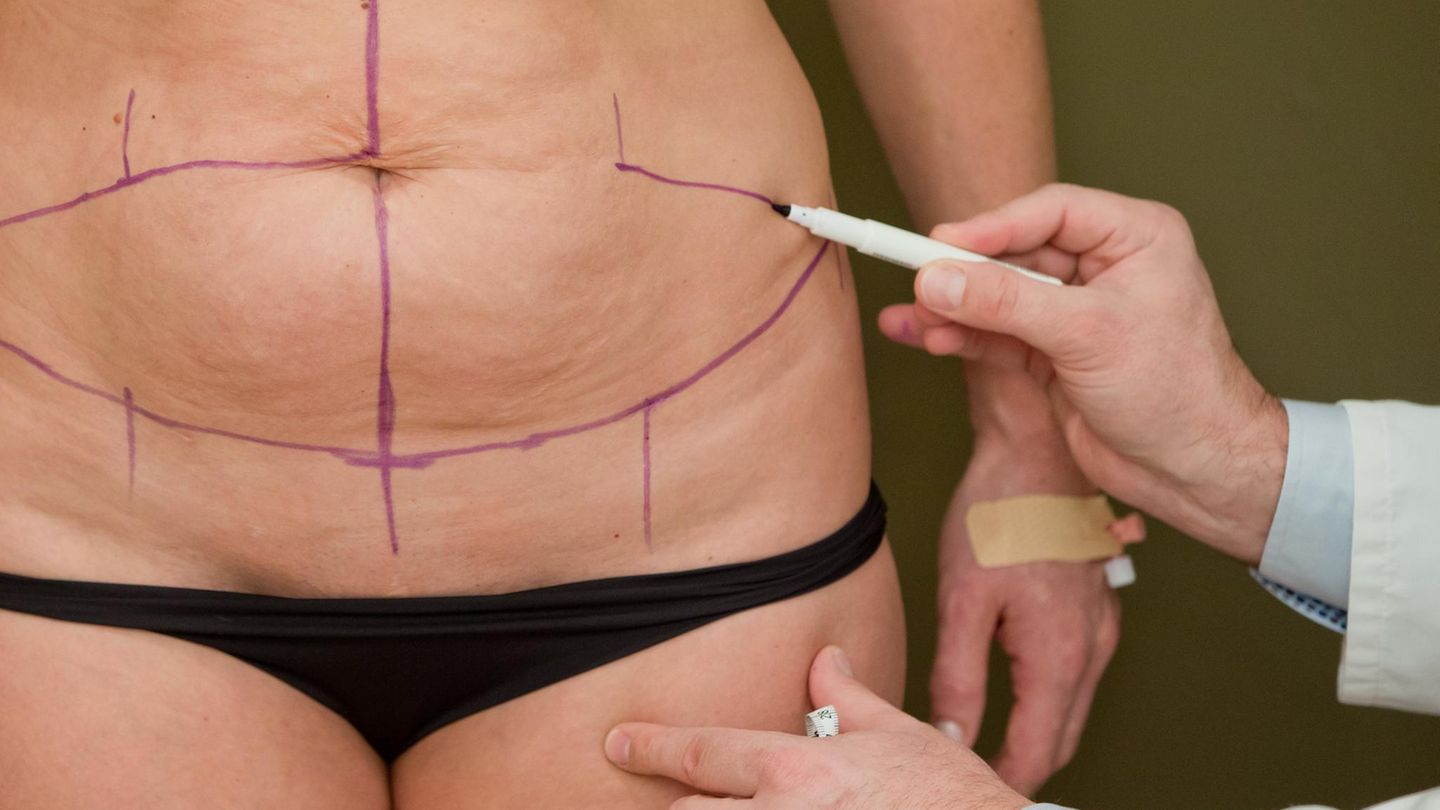 litauen plastische chirurgie
