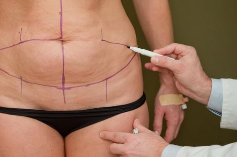 litauen plastische chirurgie