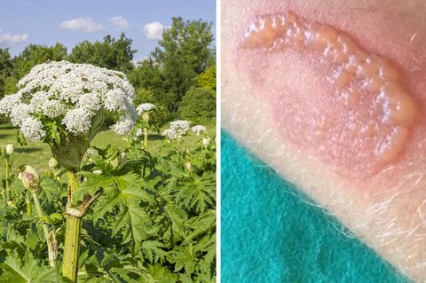 Riesenbärenklau im Selbstversuch: So gefährlich wirkt die Pflanze