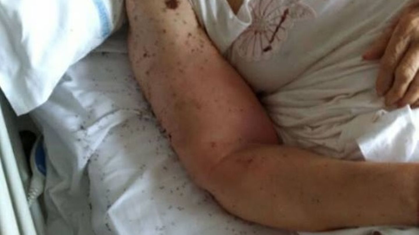 Kribbeln im Krankenzimmer: Ameisen überrennen ein Patientenbett in einer Klinik in Neapel