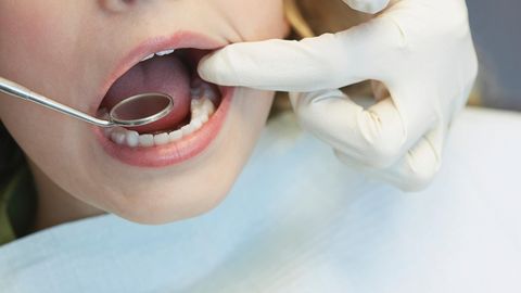 Zahnarzte So Werden Patienten Mit Teuren Behandlungen Abgezockt Stern De