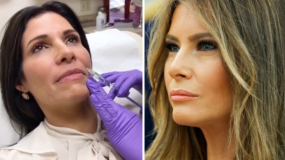 Melania Trump: Claudia Sierra lässt sich operieren, um wie First Lady auszusehen
