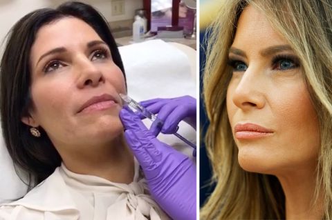 Melania Trump: Claudia Sierra lässt sich operieren, um wie First Lady auszusehen