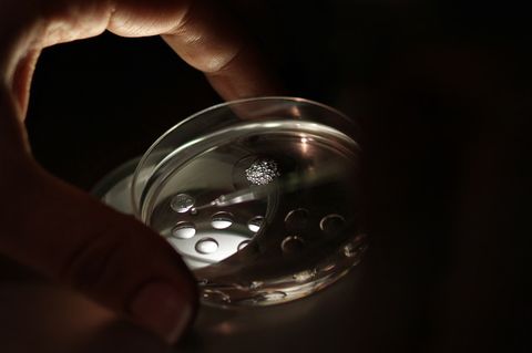Künstliche Befruchtung im Labor: Es besteht der Verdacht, dass der Reproduktionsmediziner in zahlreichen Fällen sein eigenes Sperma unter die Samenspenden mischte.