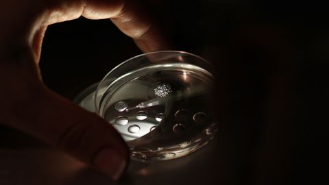Künstliche Befruchtung im Labor: Es besteht der Verdacht, dass der Reproduktionsmediziner in zahlreichen Fällen sein eigenes Sperma unter die Samenspenden mischte.