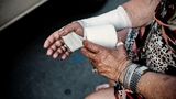 Trabert behandelt Menschen wie Anneliese Schneider, die sich an der Hand verletzt hat