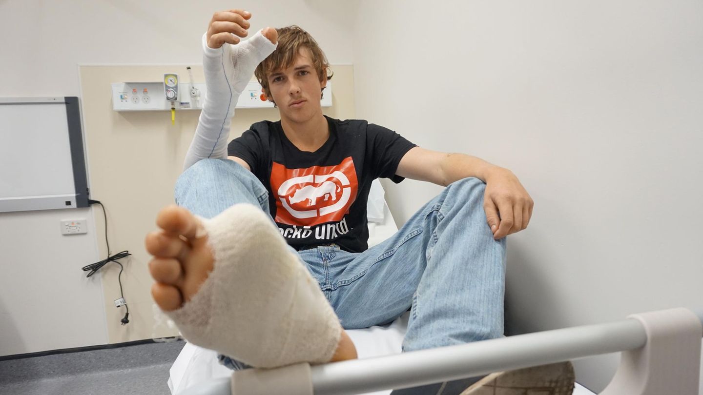 Mit dem Surfen könnte es schwierig werden, sagte der Chirurg dem jungen Australier