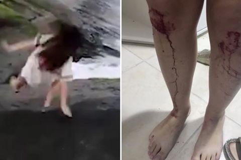 Autsch!: Mädchen rutscht auf glitschigen Felsen aus - und stürzt ins Wasser