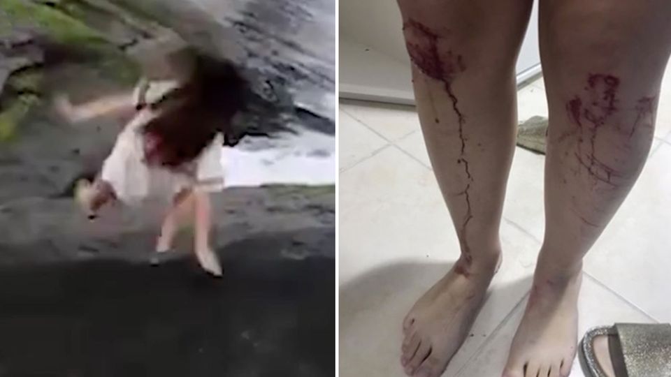 Autsch!: Mädchen rutscht auf glitschigen Felsen aus - und stürzt ins Wasser Autsch!: Mädchen rutscht auf glitschigen Felsen aus - und stürzt ins Wasser