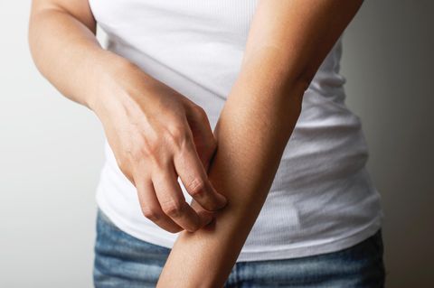 Sepsis nach Insektenstich