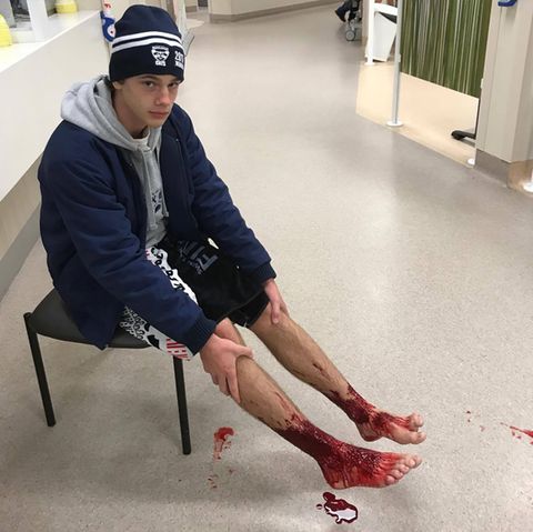 Der 16-jährige Sam wartet auf die Behandlung im Krankenhaus. Das Foto hat sein Vater aufgenommen.