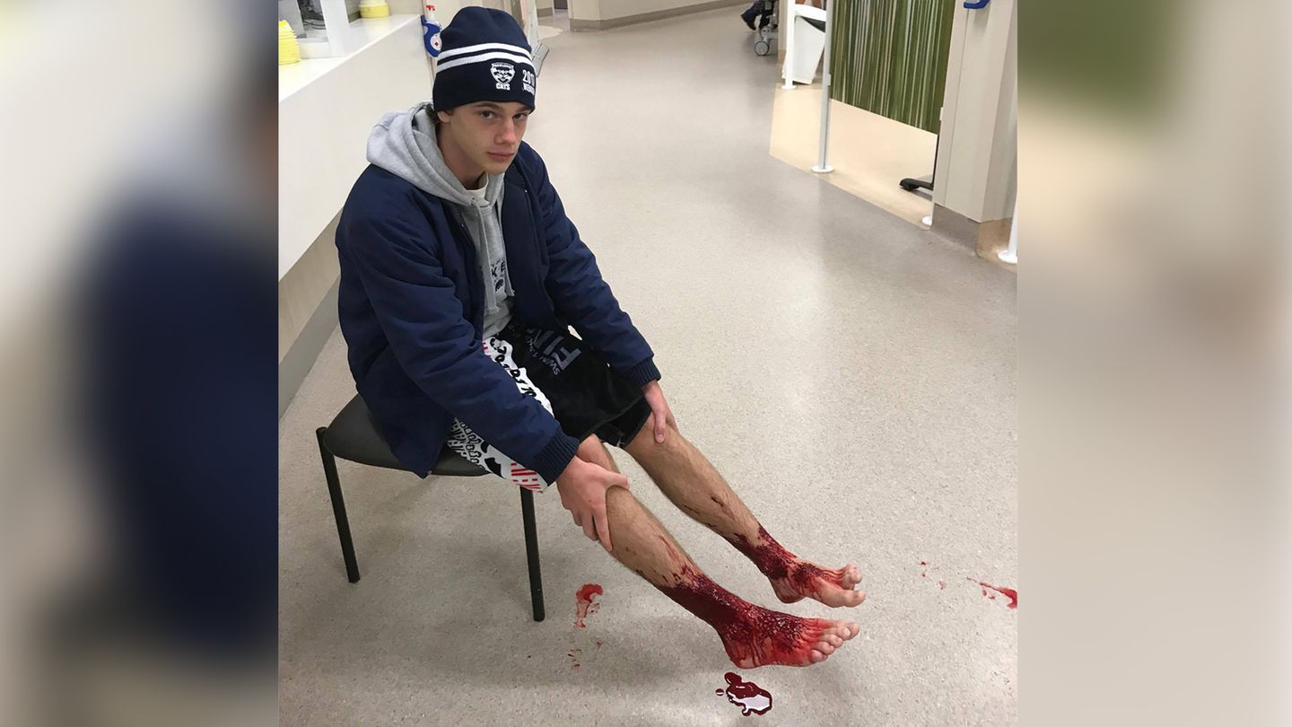 Der 16-jährige Sam wartet auf die Behandlung im Krankenhaus. Das Foto hat sein Vater aufgenommen.