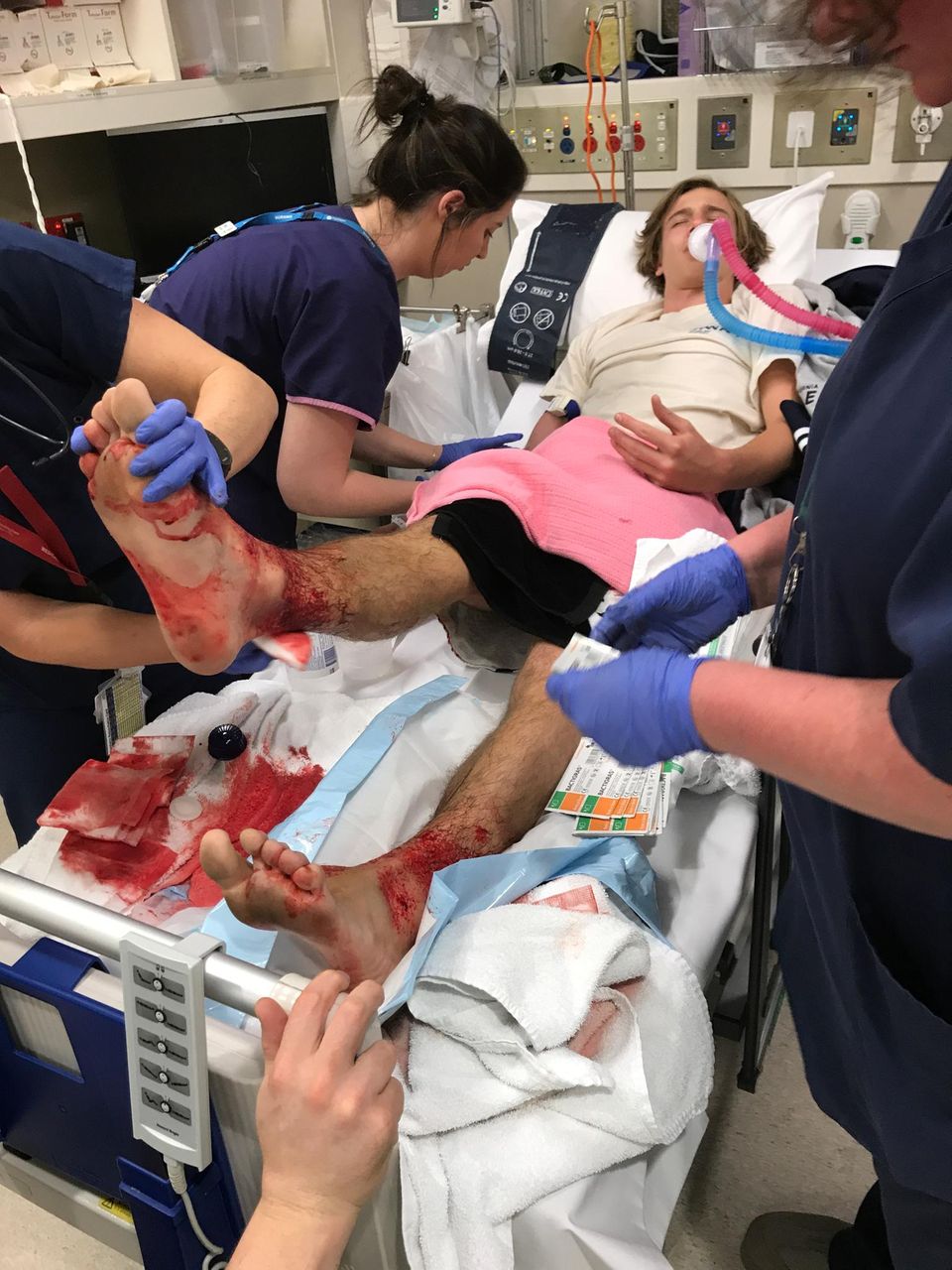 Australien: Sams Ärzte stellten zahlreiche Bisswunden in der Größe von Stecknadeln fest. Erst nach mehreren Stunden konnten die Blutungen zum Stillstand gebracht werden. Sams Ärzte stellten zahlreiche Bisswunden in der Größe von Stecknadeln fest. Erst nach mehreren Stunden konnten die Blutungen zum Stillstand gebracht werden.