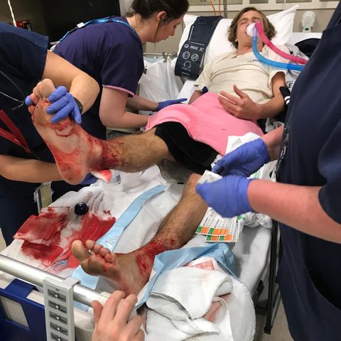 Der Schüler Sam Kanizay liegt in Melbourne im Krankenhaus mit blutenden Beinen.