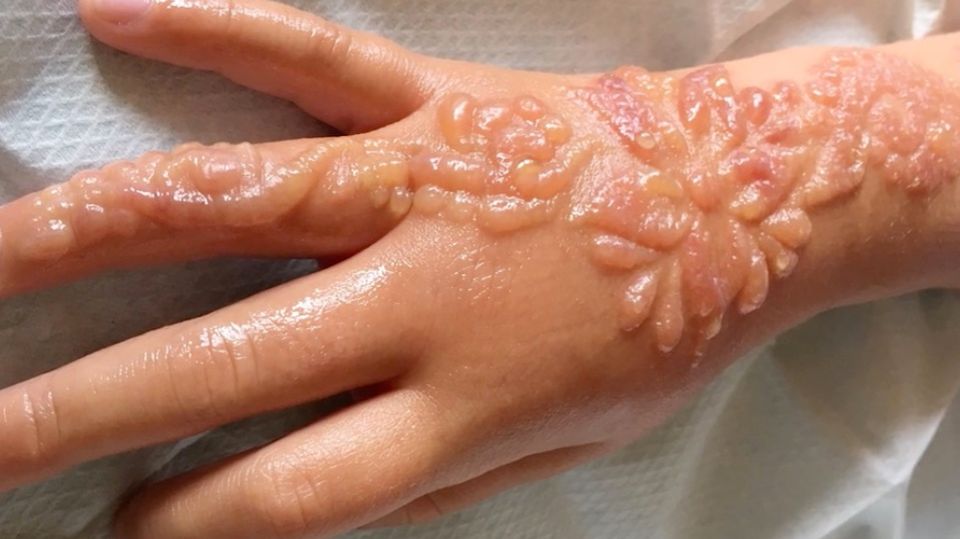 Henna