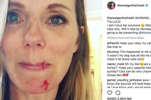 Geri Halliwell hat Schnittwunden im Gesicht