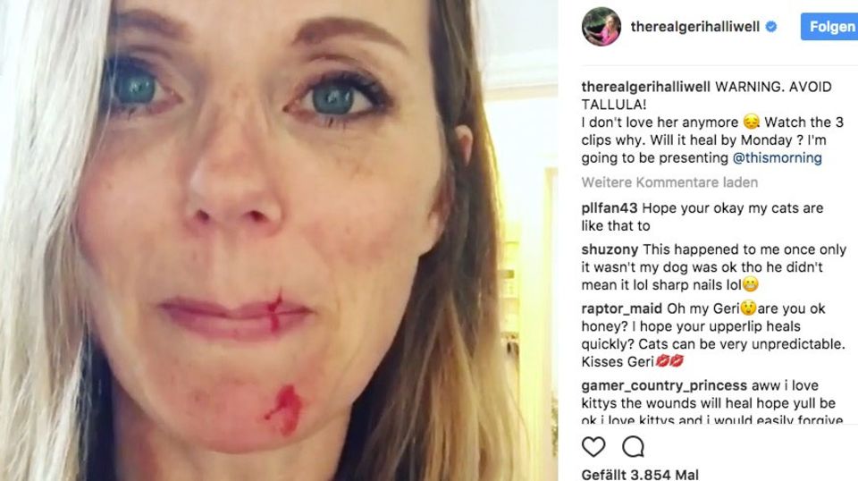 Geri Halliwell hat Schnittwunden im Gesicht Geri Halliwell hat Schnittwunden im Gesicht