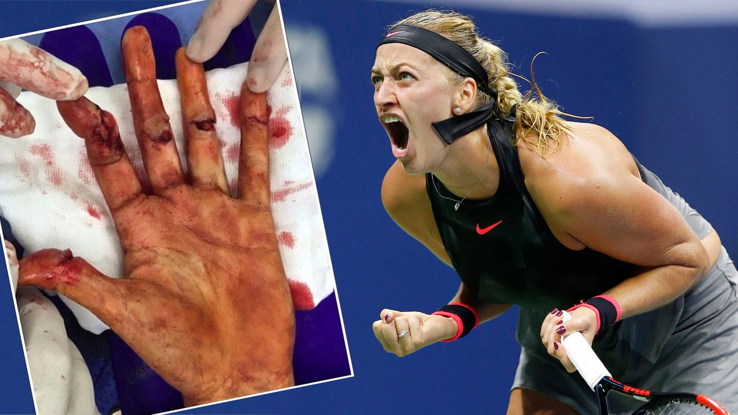 Petra Kvitova bei den US Open Messer-Attacke zerfetzte ihre Hand, jetzt greift sie nach dem Titel STERN.de