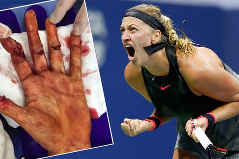 Petra Kvitova