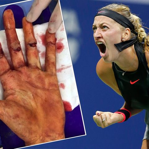 Petra Kvitova