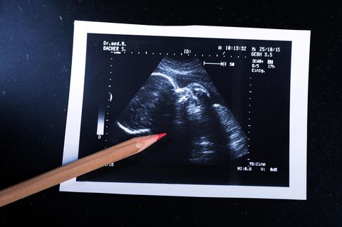 kinderwunsch ultraschall