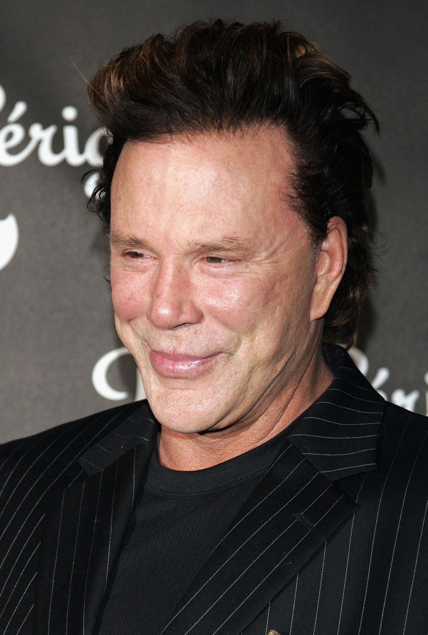 Mickey Rourke: Facelift im Wandel der Zeiten