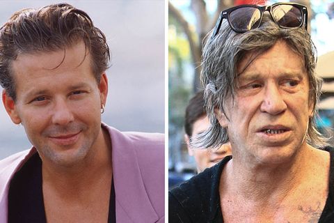 Mickey Rourke: Facelift im Wandel der Zeiten