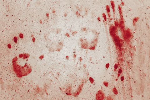 Acht vermeintliche Vampire sind in den letzten Wochen in Malawi umgebracht worden