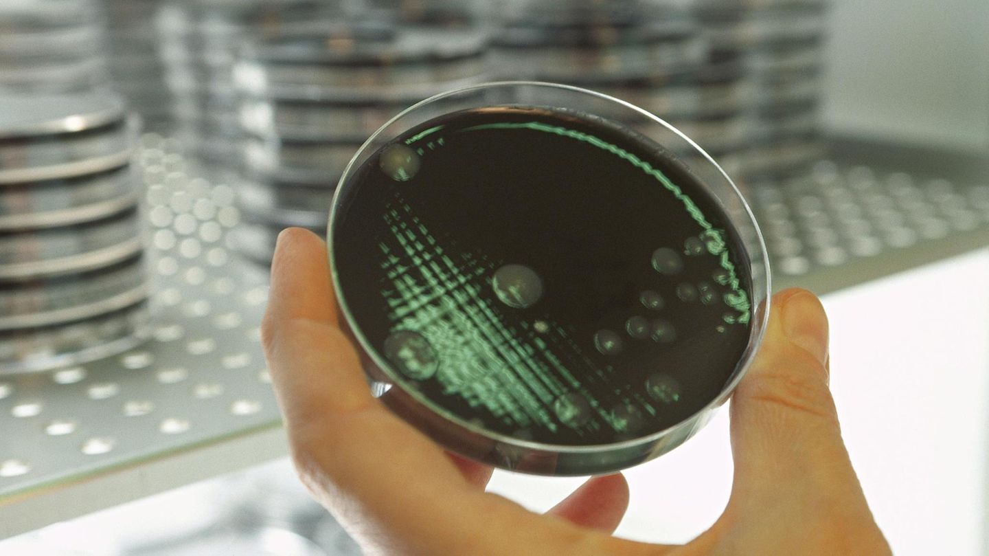 Eine Bakterienkultur in einer Petrischale. Meningokokken können eine Blutvergiftung auslösen. (Symbolbild)
