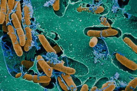 nachrichten Deutschland E.Coli