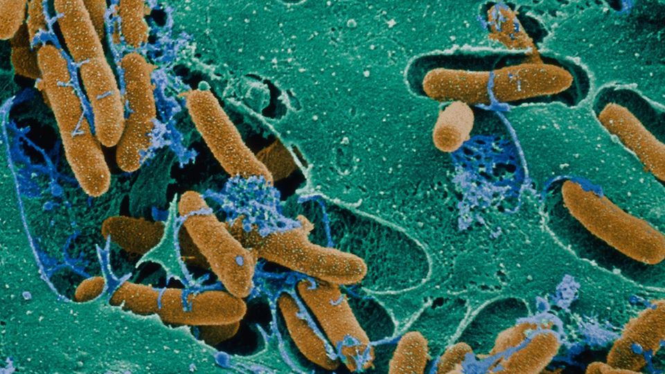 nachrichten Deutschland E.Coli nachrichten Deutschland E.Coli