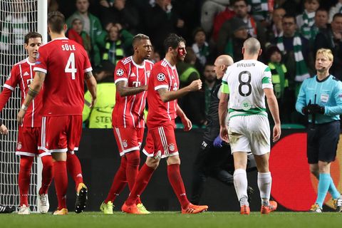 Javi Martinez (M.) holte sich bei seinem Kopfball zum 2:1 für die Bayern gegen Celtic Glasgow eine Platzwunde