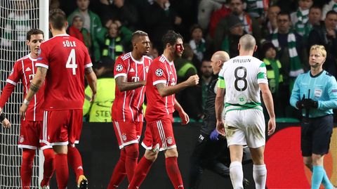 Javi Martinez (M.) holte sich bei seinem Kopfball zum 2:1 für die Bayern gegen Celtic Glasgow eine Platzwunde