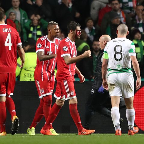 Javi Martinez (M.) holte sich bei seinem Kopfball zum 2:1 für die Bayern gegen Celtic Glasgow eine Platzwunde