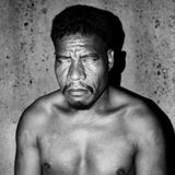 In etwa jeder zehnte bis dritte Bewohner Pingelaps (die Schätzungen variieren hier) ist Träger des Achromatopsie-Gens. Es verursacht komplette Farbenblindheit. Die an sich farbenfrohe Welt Pingelaps erscheint den Bewohnern Schwarz und Weiß.  Träger des Gens sind extrem lichtempfindlich. Werden sie geblendet, schließen sie die Augen. Das ist auch auf diesem Foto passiert: Vom hellen Licht des Blitzes geblendet, schließt Inselbewohner Eric die Augen.