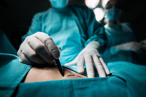 Science Care führte standardisierte und zertifizierte Umgangsweisen mit den Leichenteilen ein (Symbolfoto).