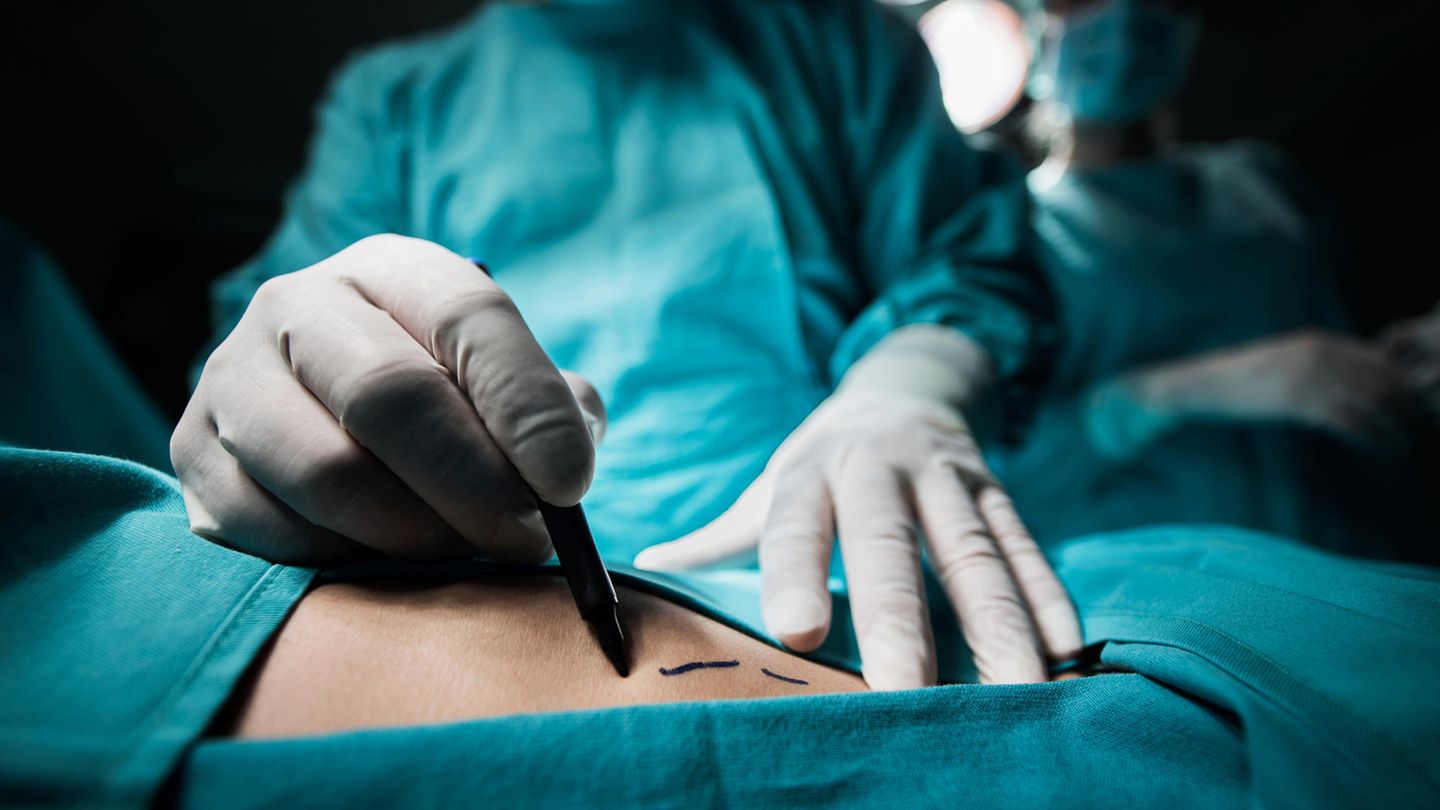 Science Care führte standardisierte und zertifizierte Umgangsweisen mit den Leichenteilen ein (Symbolfoto).