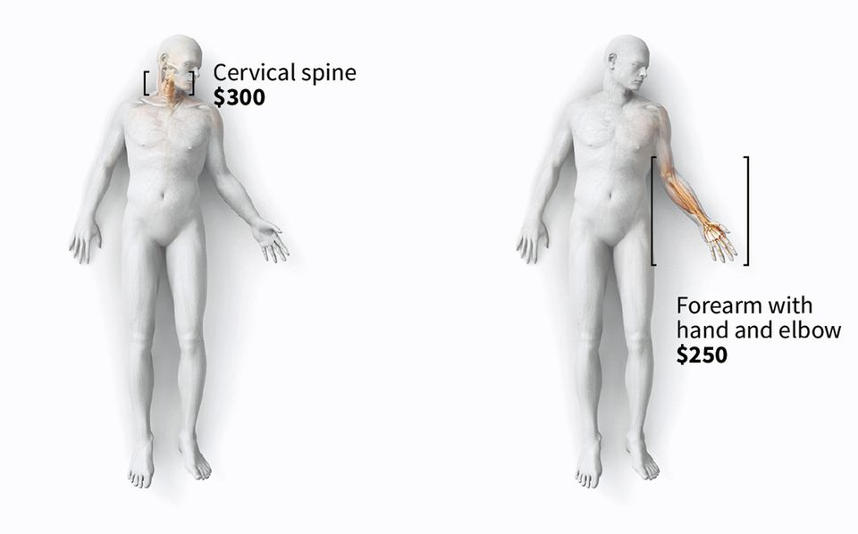 Die Halswirbelsäule kostet 300 Dollar, den Vorderarm mit Hand und Ellbogen gibt es für 250 Dollar.
