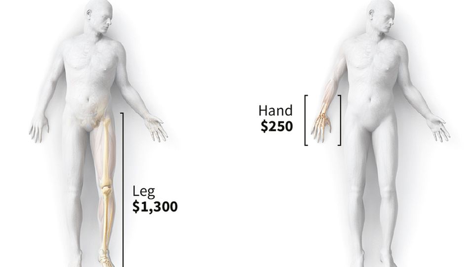 Ein komplettes Bein bringt 1300 Dollar, ein Hand nur 250.