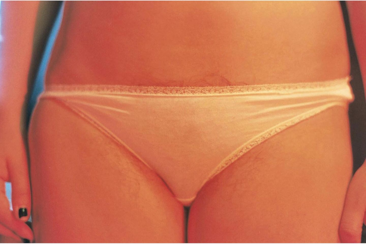 Body Positivity: "Ich zeige Körperbehaarung, Pigmentflecken, Dehnungsstreifen, Narben und Cellulite, denn wir alle kennen sie. Für manche Menschen ist es unangenehm die Bilder zu sehen, denn sie zeigen Körper so, wie sie selten dargestellt werden. Aber das gehört dazu und ist der erste Schritt, der etwas verändern kann." "Ich zeige Körperbehaarung, Pigmentflecken, Dehnungsstreifen, Narben und Cellulite, denn wir alle kennen sie. Für manche Menschen ist es unangenehm die Bilder zu sehen, denn sie zeigen Körper so, wie sie selten dargestellt werden. Aber das gehört dazu und ist der erste Schritt, der etwas verändern kann."