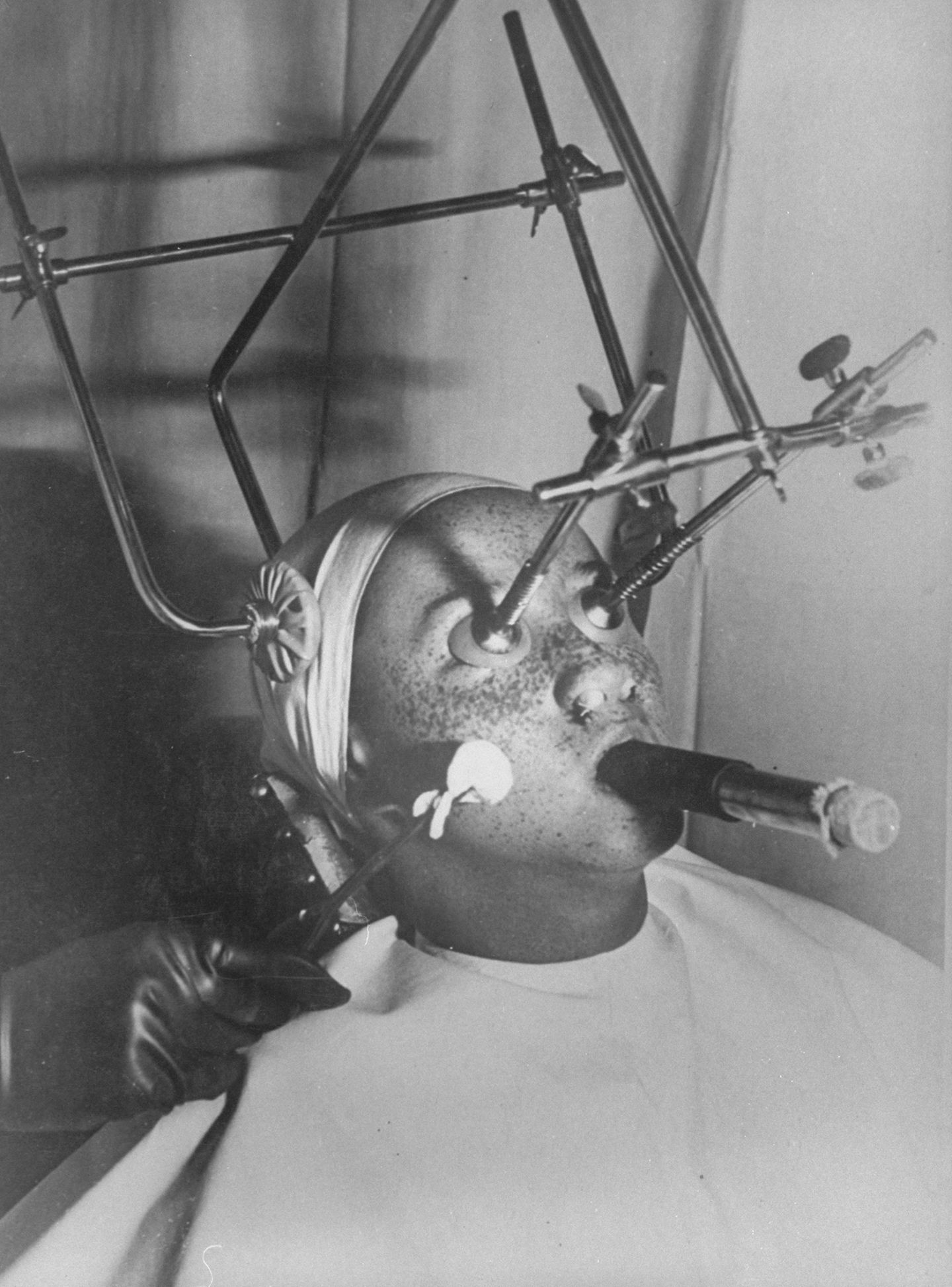 Kuriose Beauty-Gadgets aus der Vergangenheit Sommersprossen gelten heute als niedlich. Um 1930 nahmen Frauen jedoch einiges auf sich, um die Punkte im Gesichts loszuwerden. Das Bild zeigt eine Apparatur zum Entfernen der bräunlichen Flecken. Patienten bekommen im Vorfeld der Behandlung einen luftdichten Augenschutz aufgesetzt, die Nasenlöcher werden abgedichtet und die Patienten müssen durch eine speziellen Schlauch atmen. Dann beginnt die eigentliche Behandlung.
