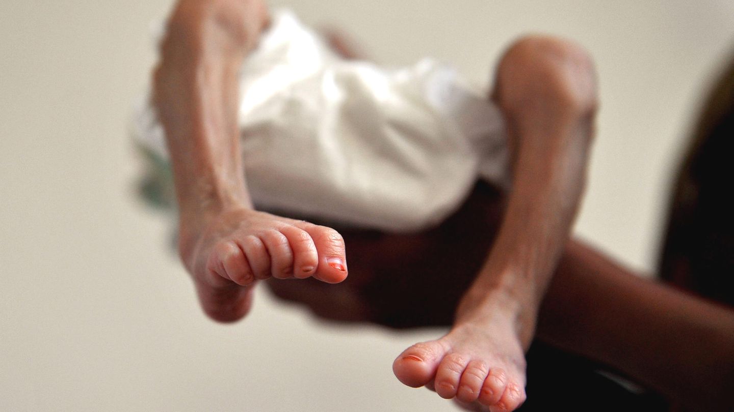 Ein unterernährtes, drei Monate altes Baby im Ernährungszentrum eines Krankenhauses in Sanaa, der Hauptstadt des Jemen