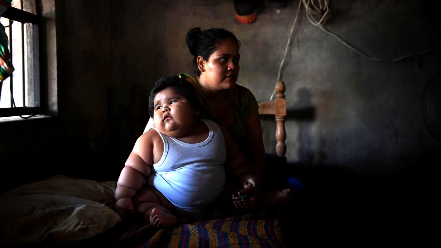Baby in Mexiko bringt 28 Kilo auf die Waage