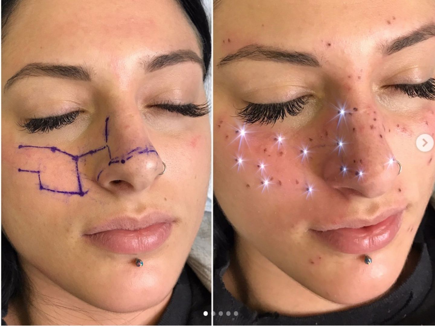 Frauen lassen sich ihre Sterne ins Gesicht tätowieren - es sieht besser aus  als es sich anhört