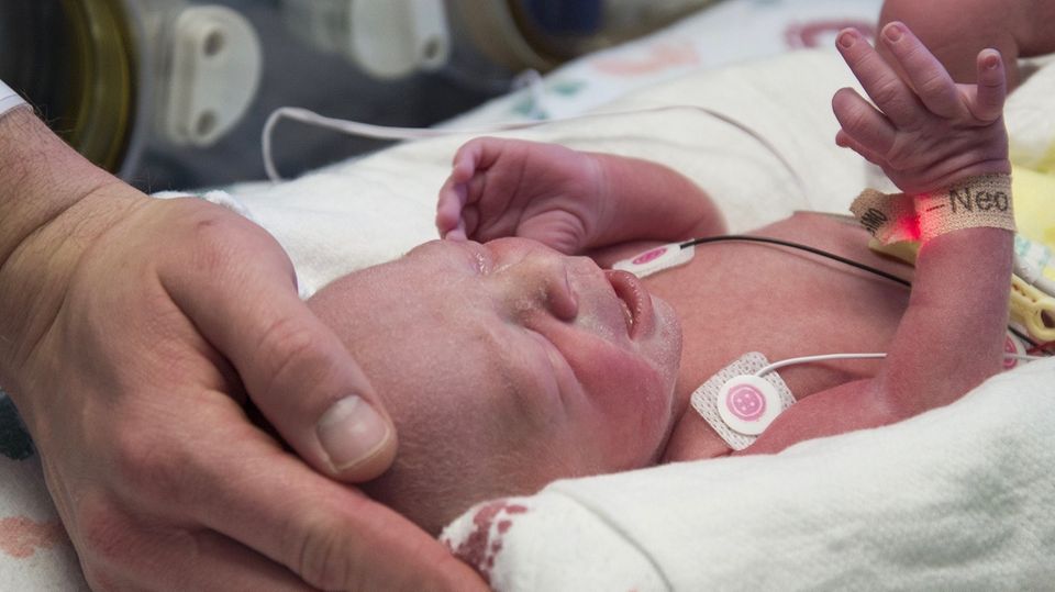 Geburt nach Gebärmutter-Transplantation Geburt nach Gebärmutter-Transplantation