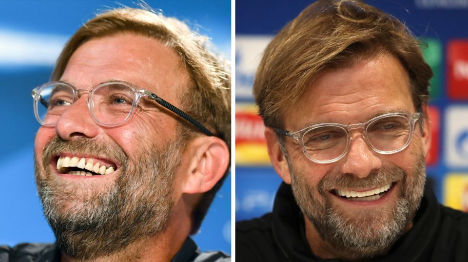 Liverpool-Trainer Jürgen Klopp links im August und rechts am Dienstag