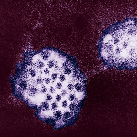 Mikroskop-Aufnahme des Norovirus